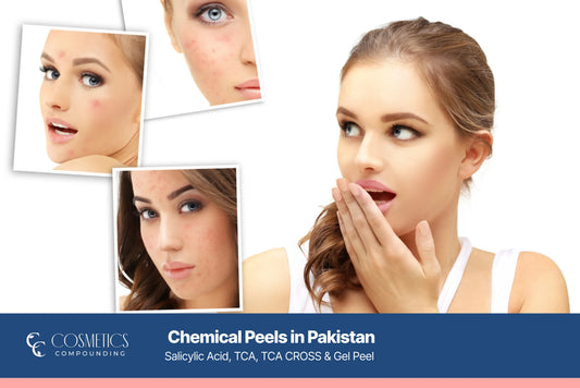 Salicylic acid, TCA, TCA CROSS and gel chemical peel treatments in Pakistan for acne scars, pigmentation and smooth glowing skin