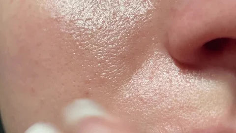 Prevention, Long-Term Maintenance, and Benefits of Oily Skin