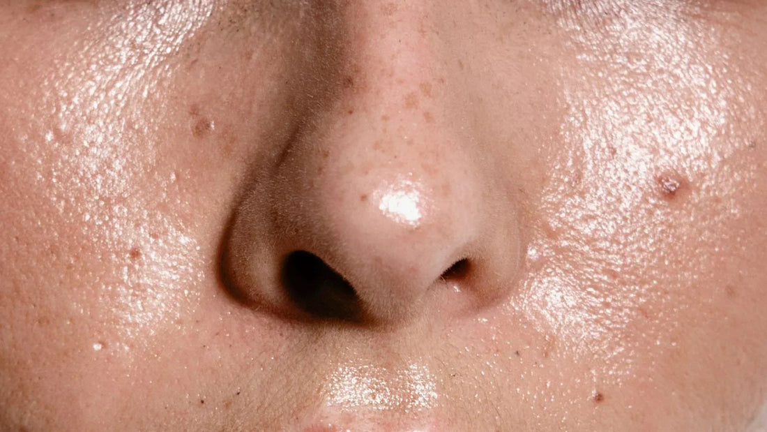 Myths, Misconceptions, and Common Mistakes about Oily Skin