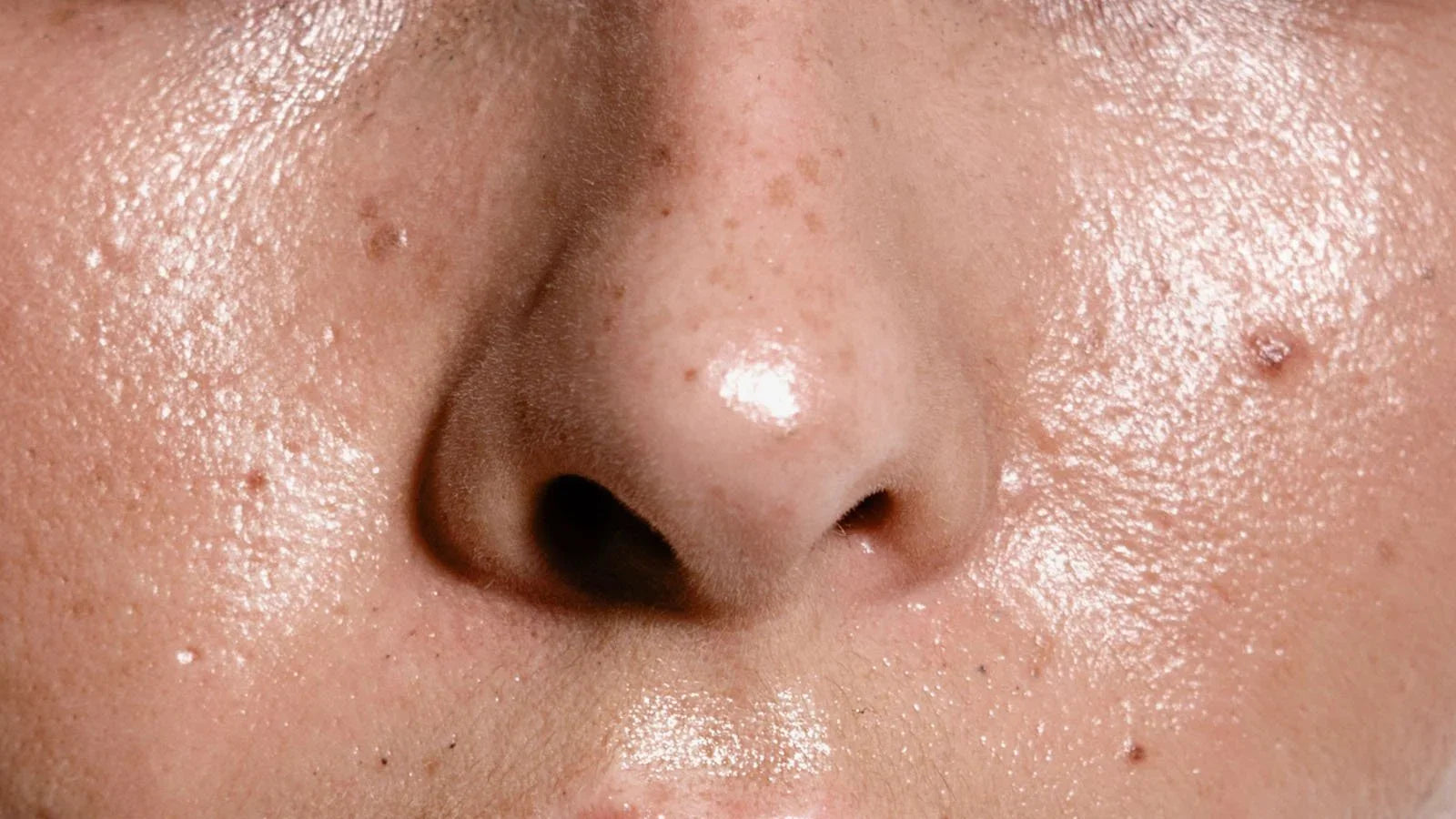 Myths, Misconceptions, and Common Mistakes about Oily Skin