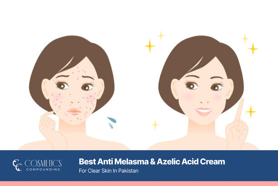 top medicated creams for melasma and dark spots in Pakistan including Azelaic acid cream, CC Anti Melasma cream, and vitamin-rich skincare