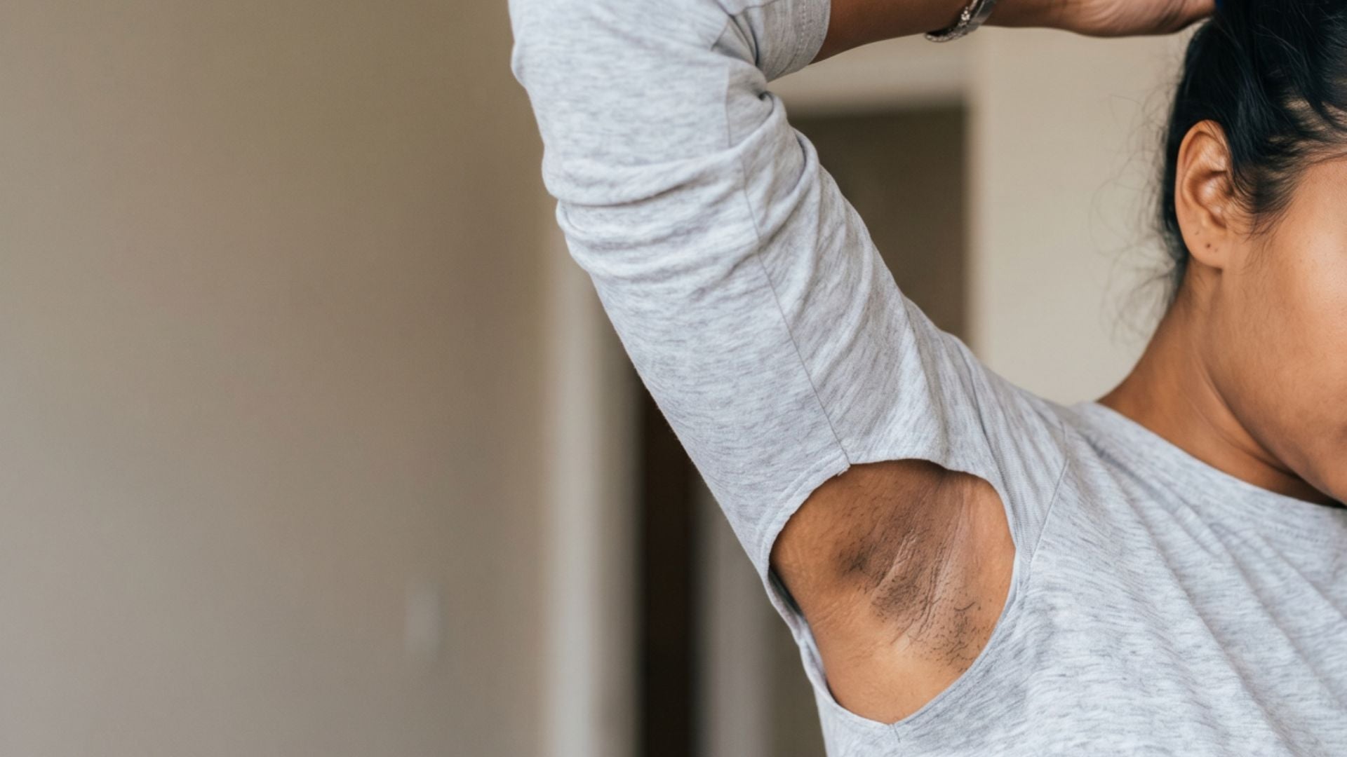 Underarm Darkness Myths and Misconceptions