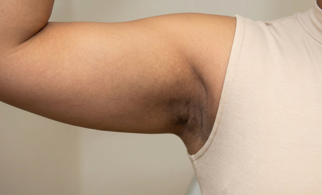 Underarm Darkening Signs, Symptoms, and Warnings