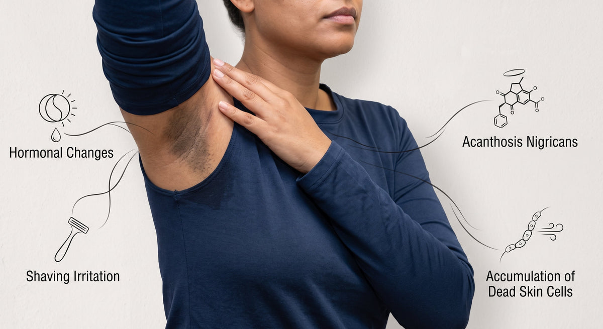 Causes of Underarm Darkness