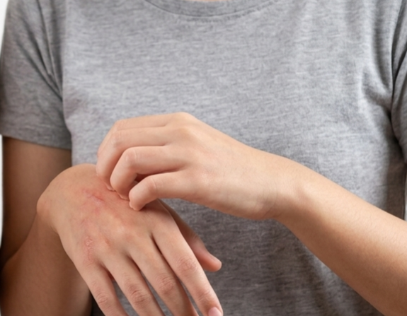 Common Mistakes and Misconceptions About Sensitive Skin