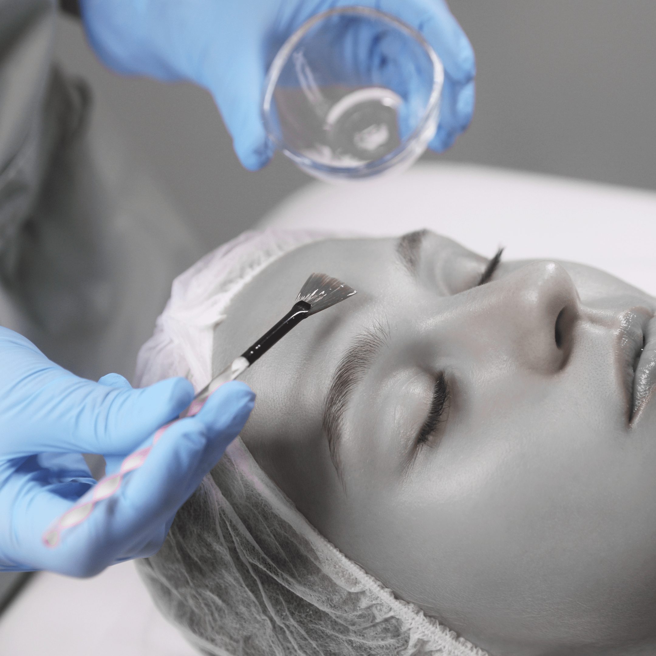 TCA Peel Results: How Strengths and Layers Affect Your Skin - Cosmetics Compounding