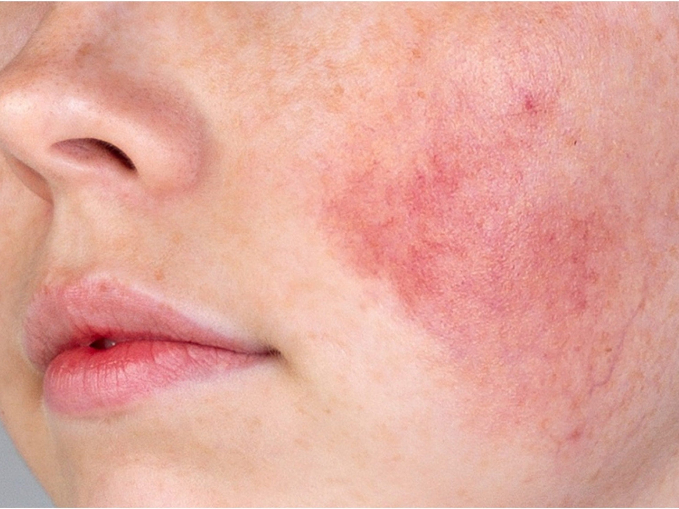 Advanced Tips and Lifestyle Strategies for Sensitive Skin