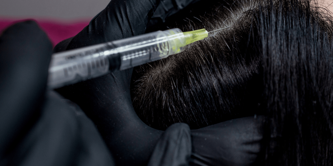 Mesotherapy in Hair Loss Management: An Established Overview - Cosmetics Compounding