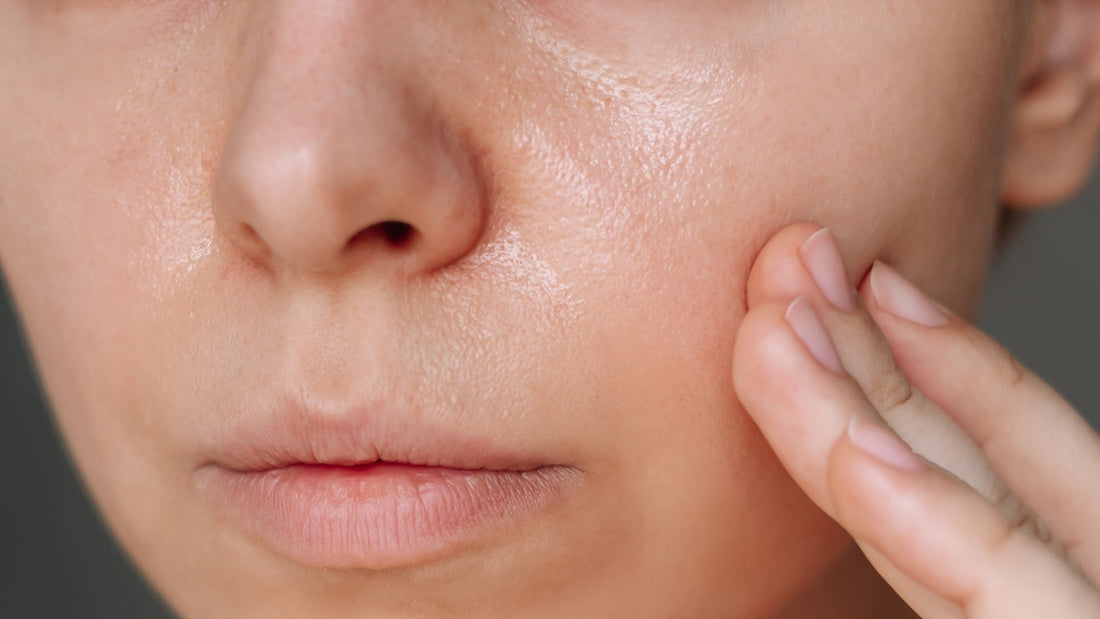 Daily Care and Routine for Oily Skin