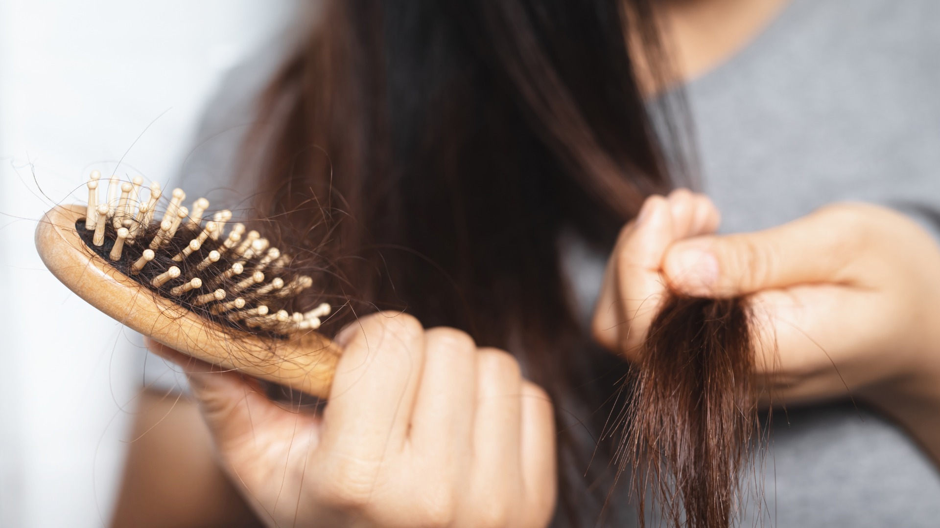 Hair Fall and Hair Loss Disorders