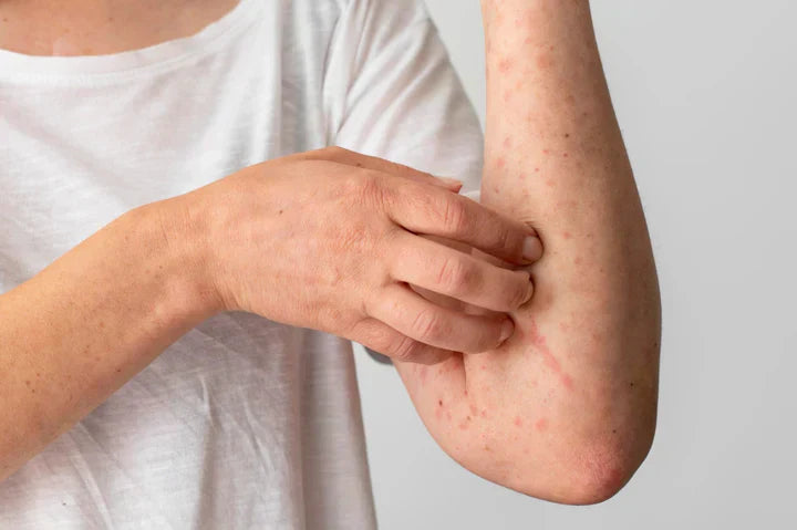 Understanding Sensitive Skin