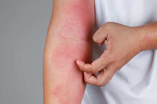 Common Triggers and Causes of Sensitive Skin