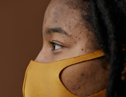 The Biological Process of How Acne Develops