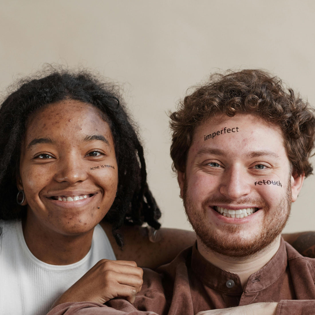 Spot Your Acne Type: Know What’s Happening on Your Skin