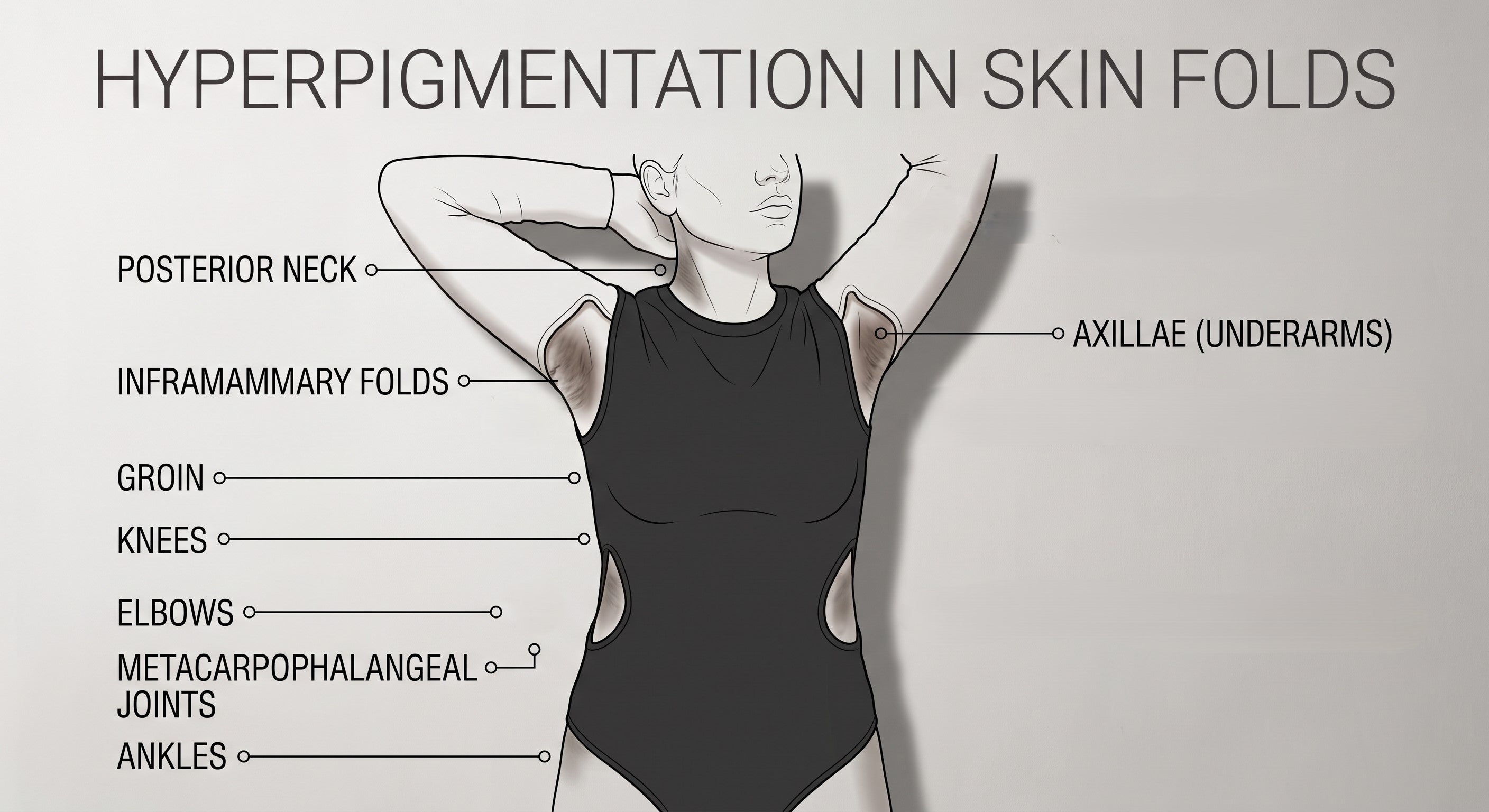 Dark Underarms and Related Skin Areas