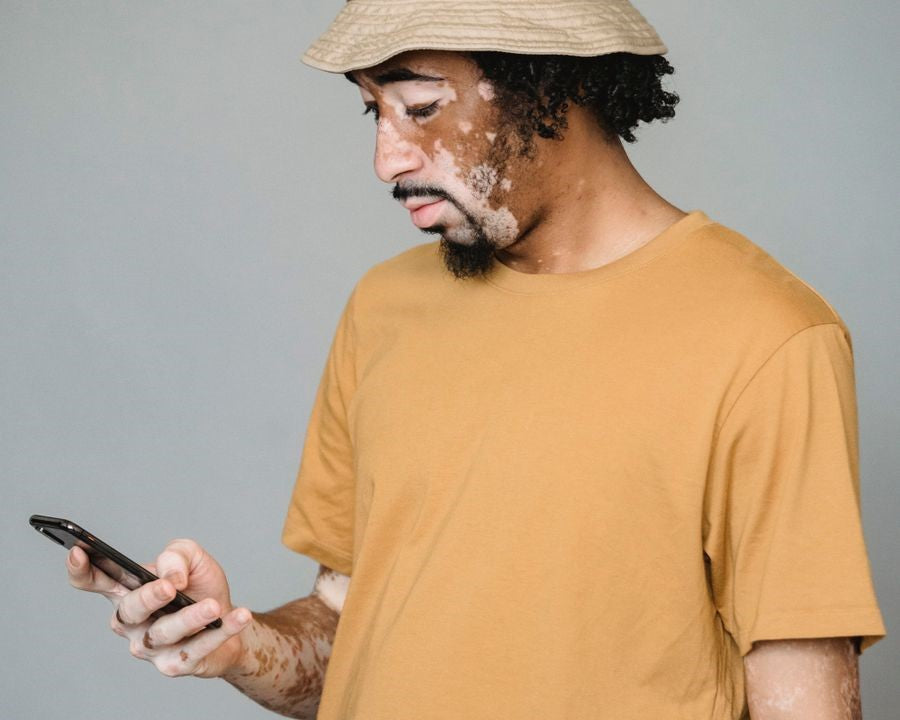 Clinical Symptoms and Stages of Vitiligo