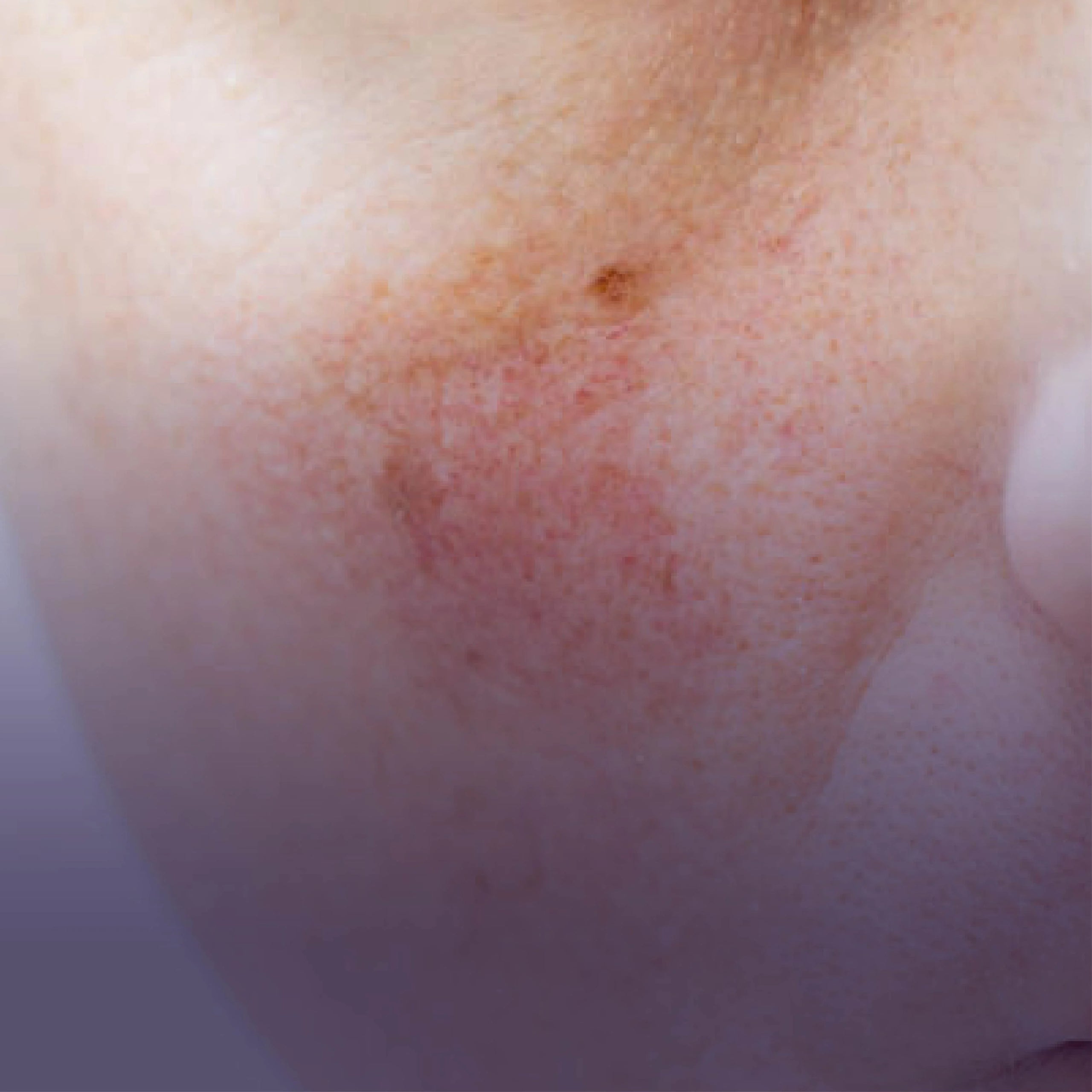 Dry & Sensitive Skin