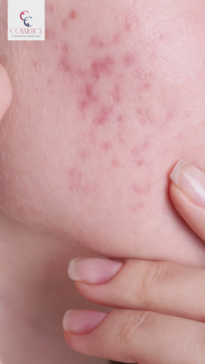 Azealic Acid Cream For Clear Skin in Pakistan - 30g