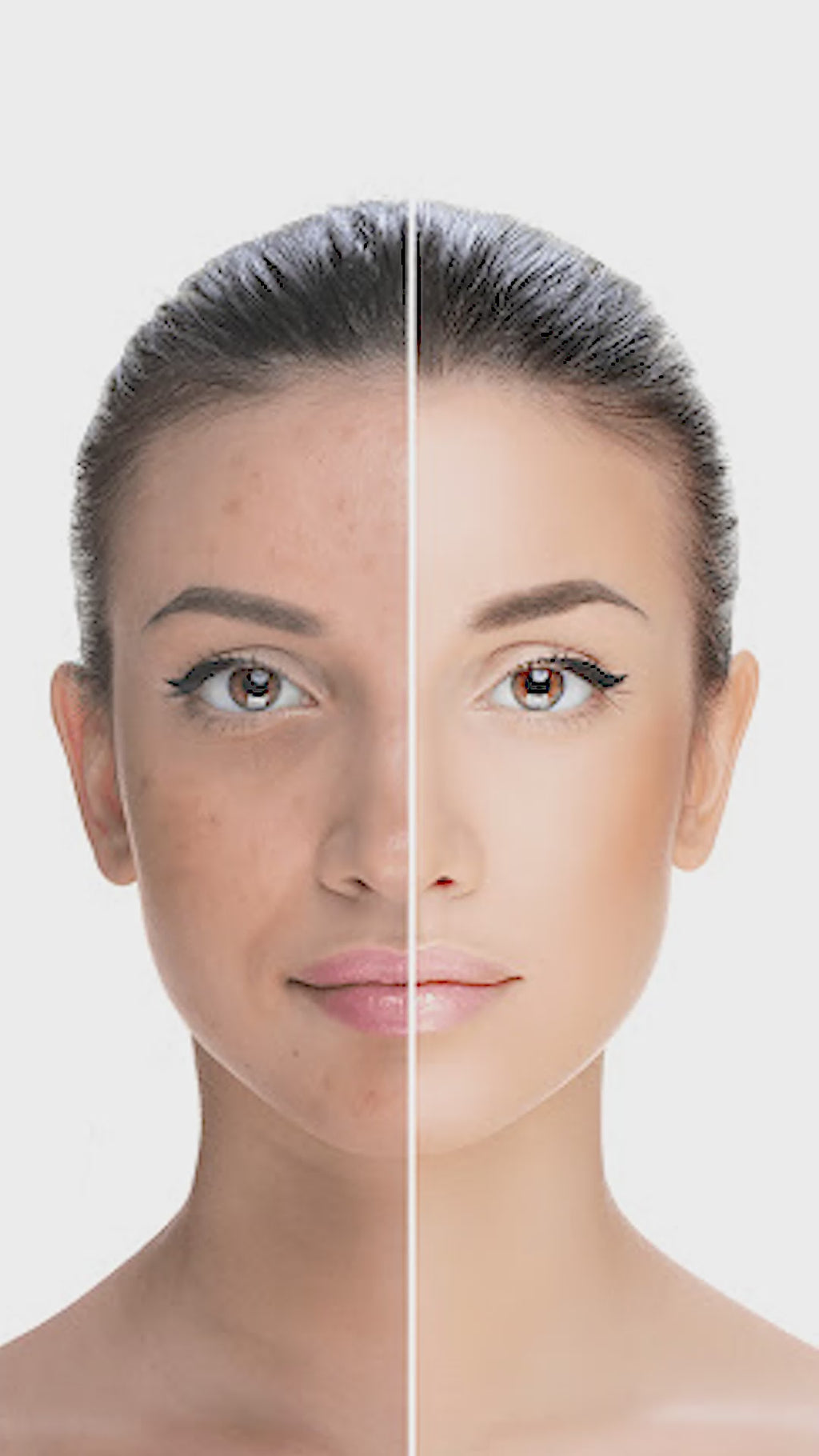 CC Anti Acne Cream